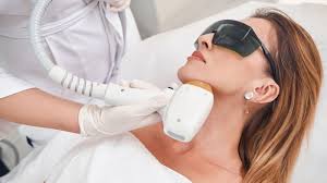 Epilation Menton à la Cire