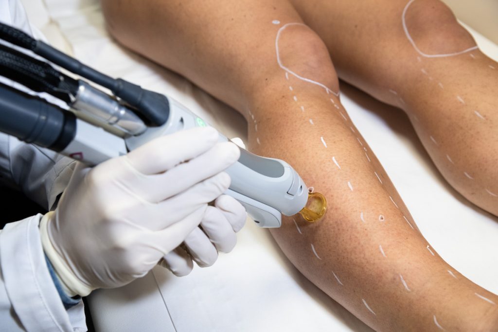 Epilation Demi-Jambe au Laser