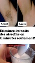 Epilation Aisselle simple à la Cire