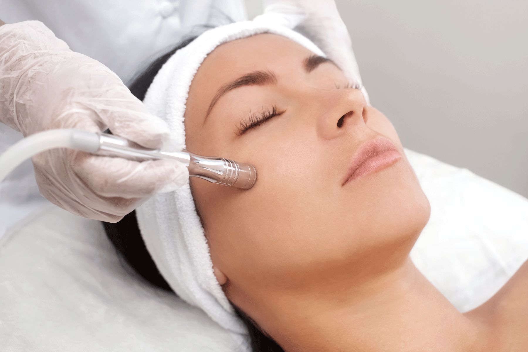 Microneedling (Visage)