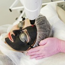 Carbone Peeling (Package de 4 séances)
