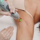 Épilation Maillot Intégral 